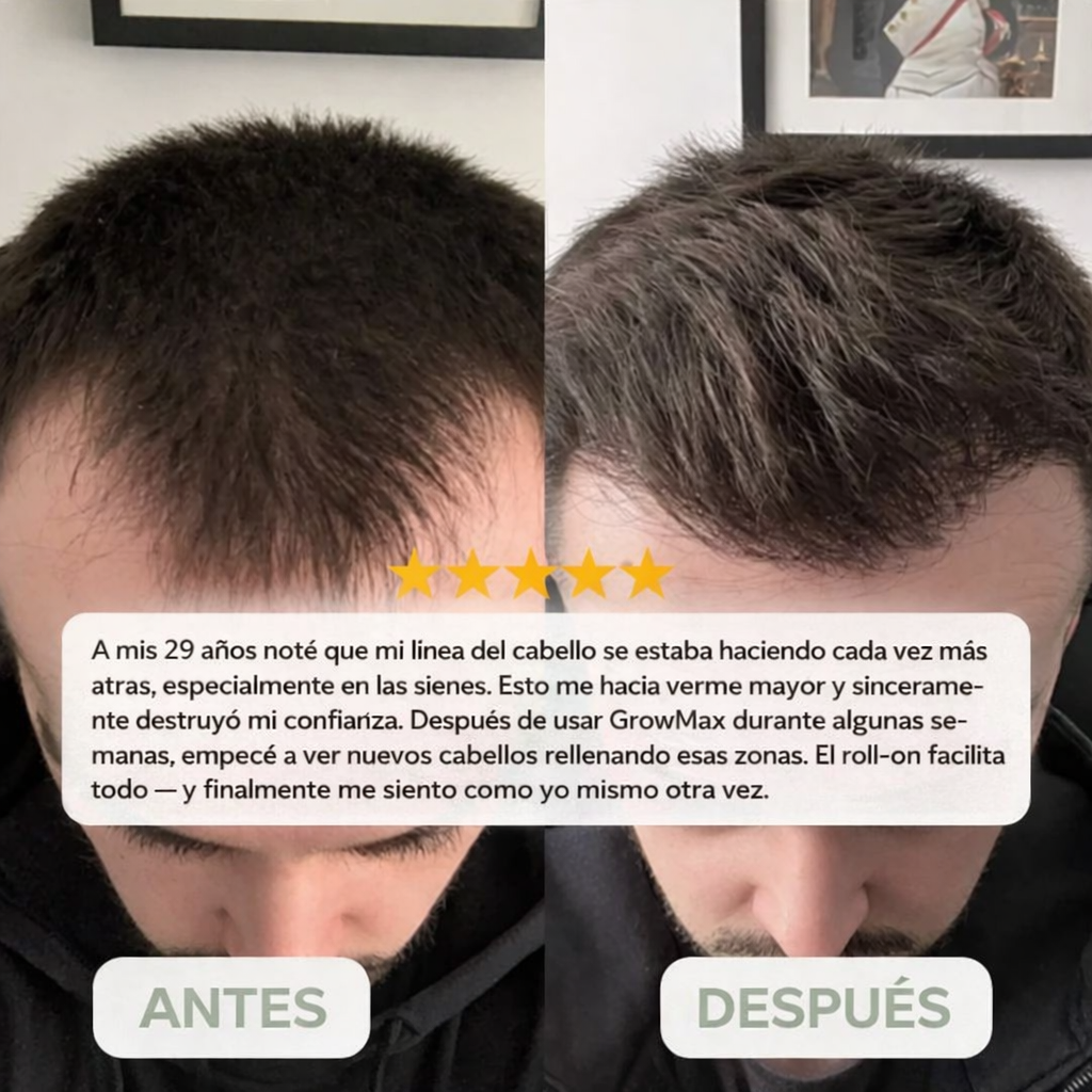 GROWMAX™ | Sérum para el crecimiento del cabello en roll-on