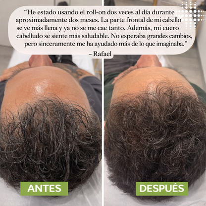 GROWMAX™ | Sérum para el crecimiento del cabello en roll-on